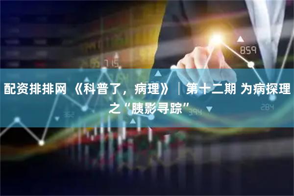 配资排排网 《科普了，病理》│第十二期 为病探理 之“胰影寻踪”